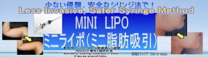 liposonix